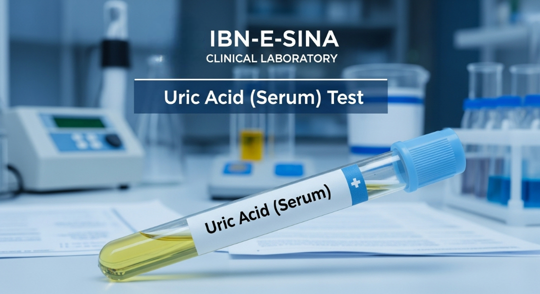 Yellow serum sample tube labeled "Uric Acid (Serum)" for clinical test at Ibn-E-Sina Laboratory, with lab equipment