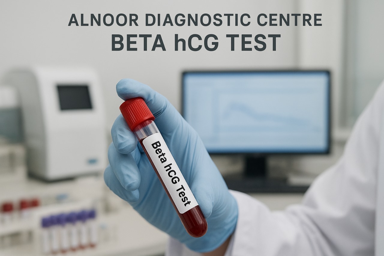 Doctor holding blood sample for Beta hCG test at Alnoor Diagnostic Centre