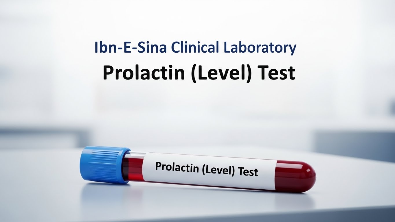 Blood sample tube labeled Prolactin (Level) Test from Ibn-E-Sina Clinical Laboratory