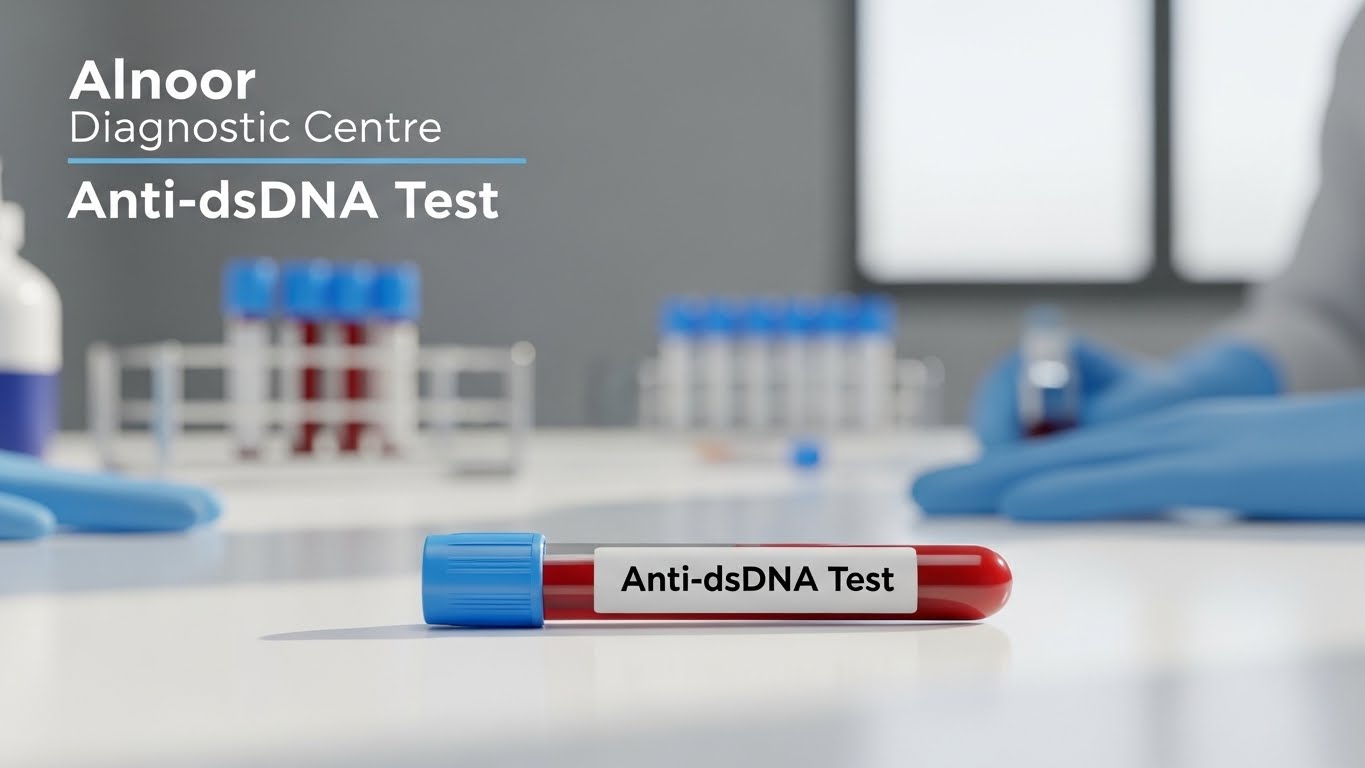 Alnoor Diagnostic Centre Anti-dsDNA Test blood sample tube placed on a laboratory table with blue-capped vials and medical equipment in the background.