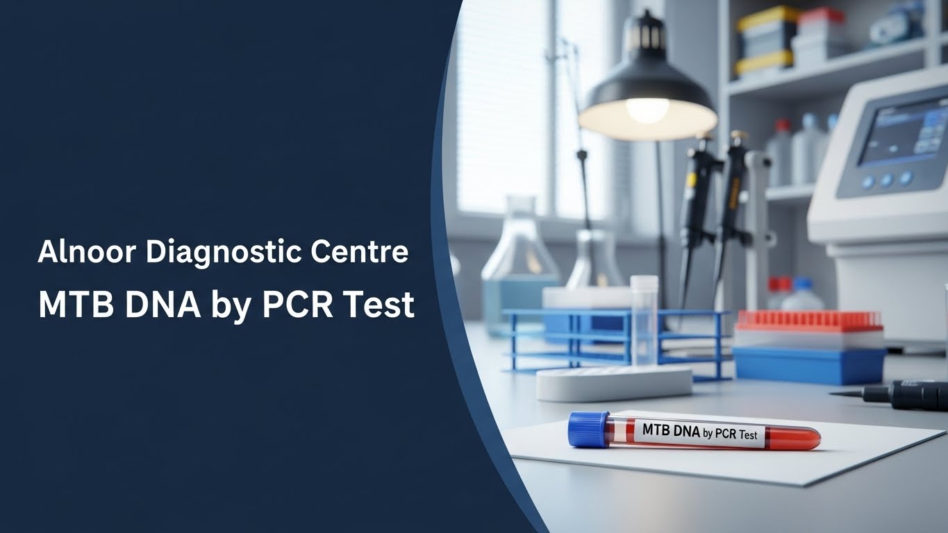 Alnoor Diagnostic Centre MTB DNA by PCR Test sample tube placed on a laboratory table with testing equipment in the background.