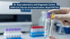 Sample tubes labeled SARS-CoV-2 Nucleic Acid Amplification / Rapid PCR Test being held in a gloved hand at Dr. Essa Laboratory and Diagnostic Centre.