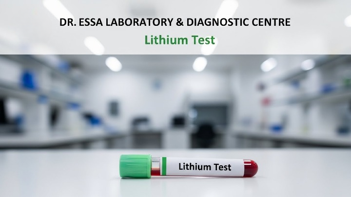 Lithium Test blood sample tube displayed at Dr. Essa Laboratory and Diagnostic Centre for accurate lithium level testing