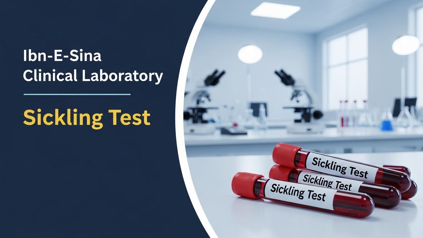 Sickling Test blood samples at Ibn-E-Sina Clinical Laboratory for detecting Hemoglobin S