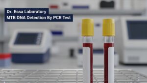 Dr. Essa Laboratory MTB DNA Detection by PCR Test with blood sample tubes in a clinical lab setting.