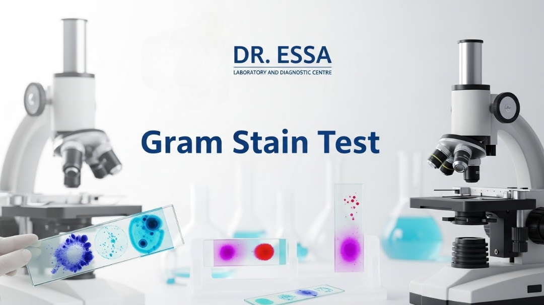 Gram Stain