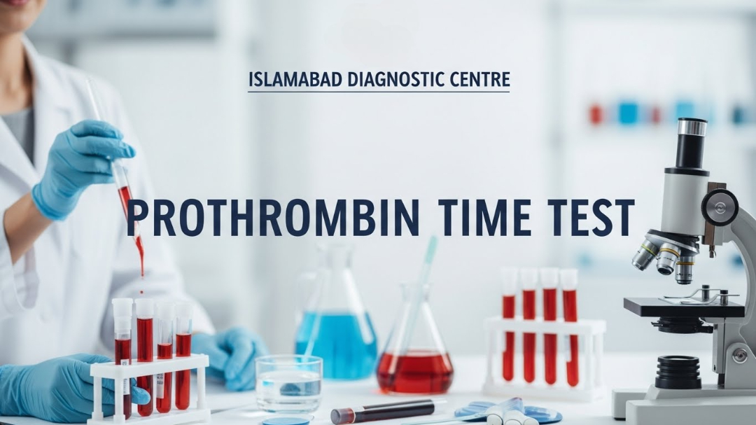 Prothrombin Time Test