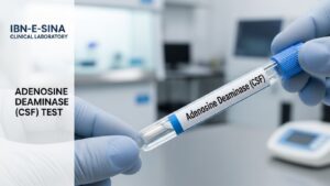 Adenosine Deaminase CSF Test at Ibn-E-Sina Clinical Laboratory in Pakistan