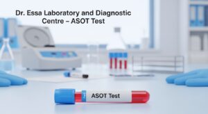 ASOT Test blood sample tube at Dr. Essa Laboratory and Diagnostic Centre used for Antistreptolysin O Titer testing